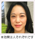 Tさん 40代